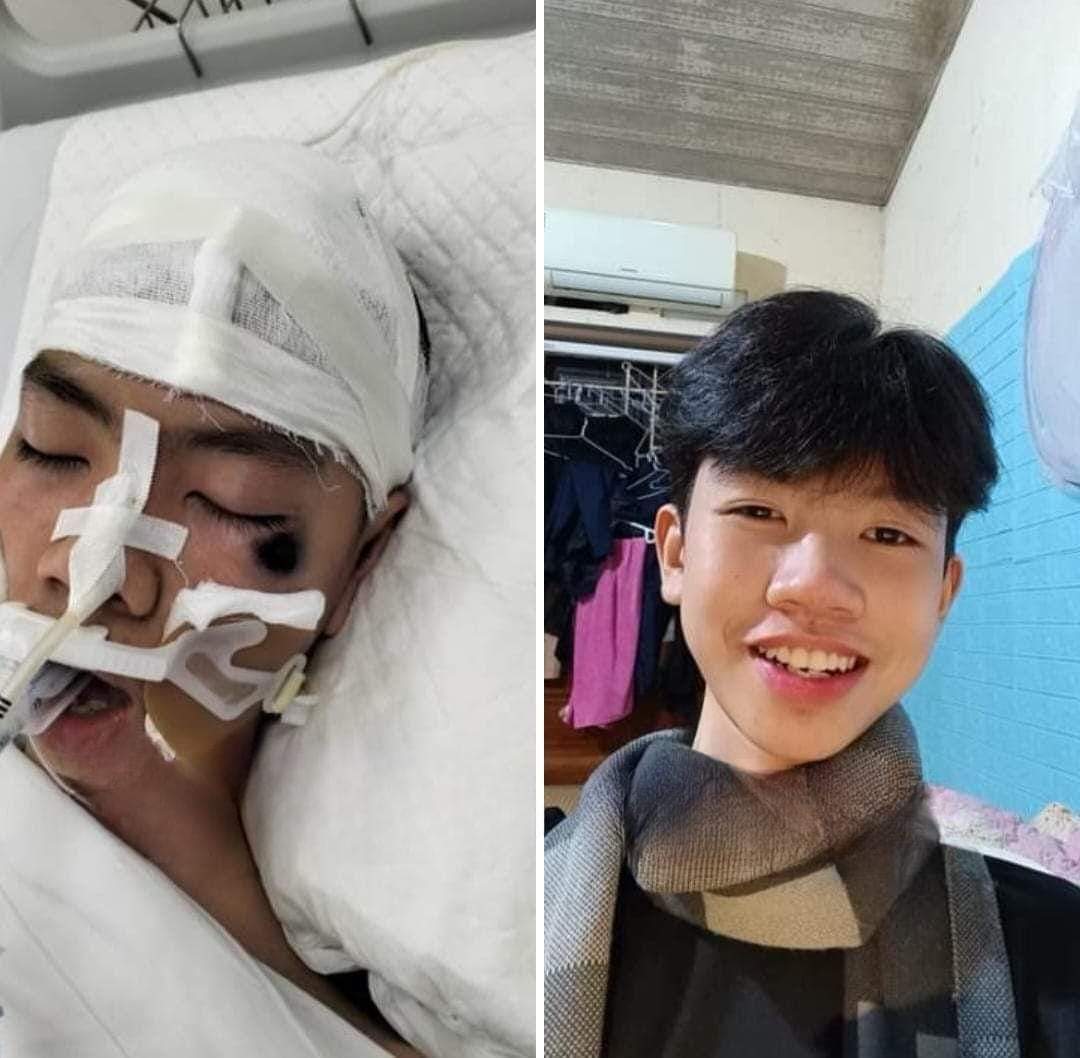 Cháu bé xấu số.jpg