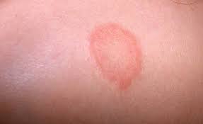 tải xuống (5).jpeg