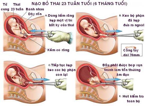 pha-thai3.jpg
